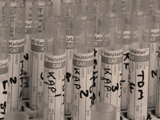 Drug Test